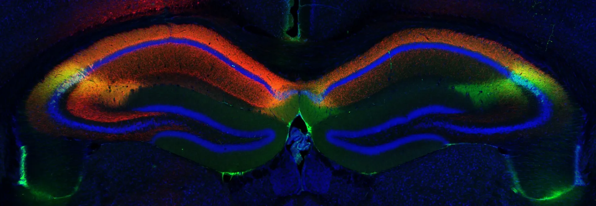 Coronal Section Red Green.jpg