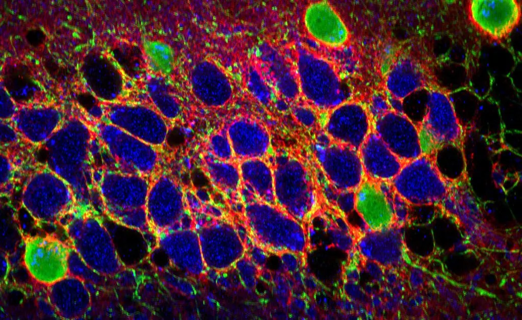 The perineuronal net extracellular matrix of the hippocampal CA2 subfield