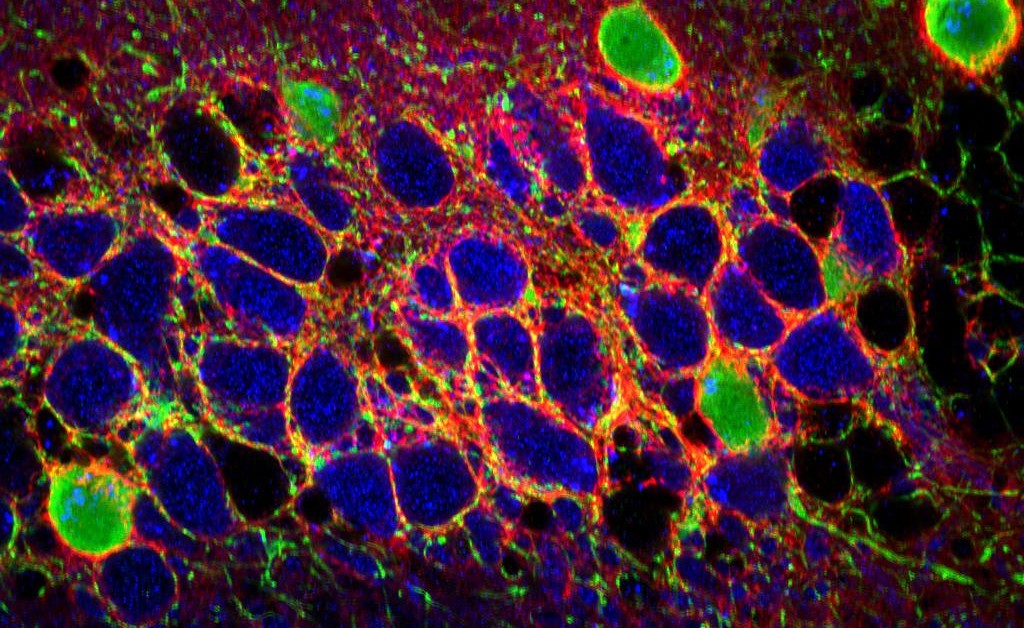 The perineuronal net extracellular matrix of the hippocampal CA2 subfield